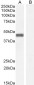 Goat Anti-Pleckstrin Antibody