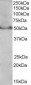 Goat Anti-PPAR delta (Isoform 1) Antibody