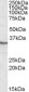 Goat Anti-PPP4C Antibody