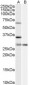 Goat Anti-PRPF31 Antibody