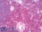 Goat Anti-PTPN6 / SHP1 (internal region) Antibody