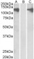 Goat Anti-PUM2 Antibody