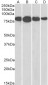 Goat Anti-Radixin Antibody