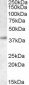 Goat Anti-RNF2 / dinG Antibody