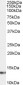 Goat Anti-S100A4 / CAPL Antibody