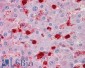 Goat Anti-S100A9 Antibody