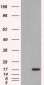 Goat Anti-SH2D1A/SLAM associated protein Antibody