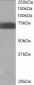 Goat Anti-SHP2 / PTPN11 Antibody