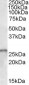 Goat Anti-SMN1 / SMN2 Antibody