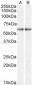 Goat Anti-SMO (C Terminus) Antibody