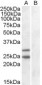 Goat Anti-SOCS1 Antibody