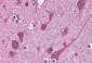 Goat Anti-STAP2 / BKS Antibody