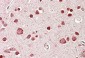 Goat Anti-STK39 / SPAK Antibody