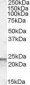 Goat Anti-SM22 Alpha / Transgelin Antibody