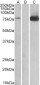 Goat Anti-TAK1 / MAP3K7 Antibody