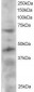 Goat Anti-TERF1 / PIN2 Antibody