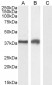 Goat Anti-TIM3 / HAVCR2 Antibody