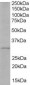 Goat Anti-TIRAP / Mal (Isoform b) Antibody