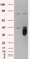 Goat Anti-Tissue Factor Pathway Inhibitor Antibody