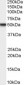 Goat Anti-Tissue Factor Pathway Inhibitor Antibody