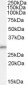 Goat Anti-TPD52L2 / D54 Antibody