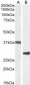 Goat Anti-Uncoupling protein 2 / UCP2 Antibody
