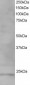 Goat Anti-VPS28 Antibody