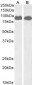 Goat Anti-VPS35 / MEM3 Antibody