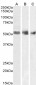 Goat Anti-Wilms tumor 1 / WT1 Antibody