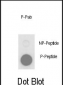 Phospho-PLB(T17) Antibody