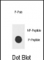 Phospho-E2F1(H357) Antibody