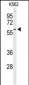 PKM2 Antibody (C-term L398)