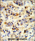 EGFR Antibody