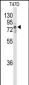 TNK1 Antibody