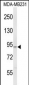 PIK3CG Antibody