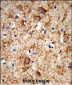 PNOC Antibody (Center)