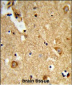 ENTPD2 Antibody (N-term)