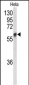 GALNT2 Antibody (N-term)