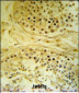 IMP4 Antibody (C-term)