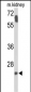 SMNDC1 Antibody (N-term)