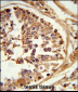 LIPE Antibody (C-term)