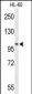 LIPE Antibody (C-term)