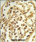 TBX1 Antibody (C-term)