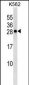 CXXC4 Antibody (C-term)