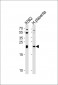 IL31 Antibody (N-term)