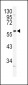 ADRA1B Antibody (Center)