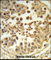 DIAPH2 Antibody (Center)
