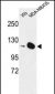 DIAPH2 Antibody (Center)