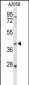 FUT3 Antibody (C-term)