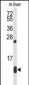 HBA2 Antibody (Center)